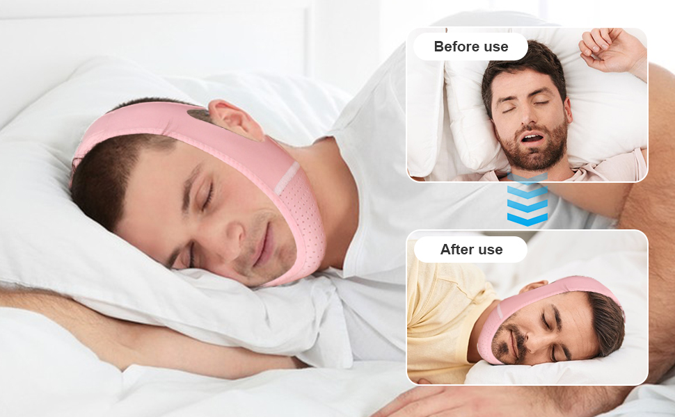 chin strap for snoring