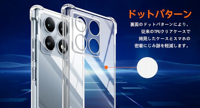 Amazon.co.jp: 対応 Xiaomi 14T Pro ケース Xiaomi 14T Pro