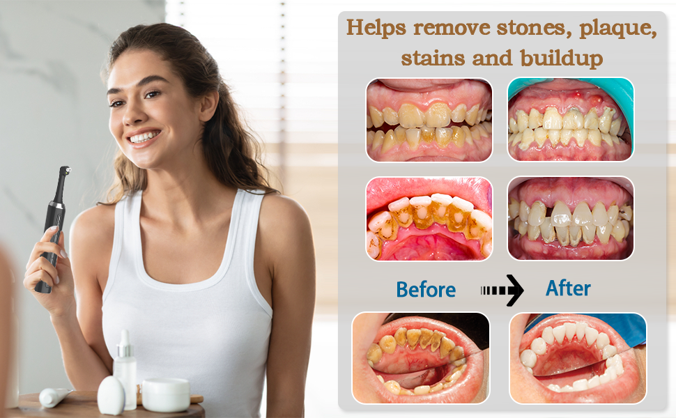 Lucidatore elettrico per denti