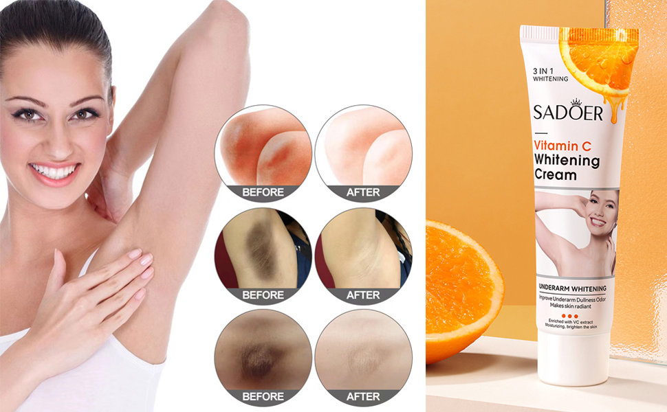 skin lightening cream whitening cream