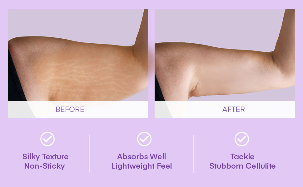 b flex lift and firm arm cream