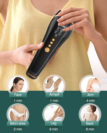 ipl hair removal