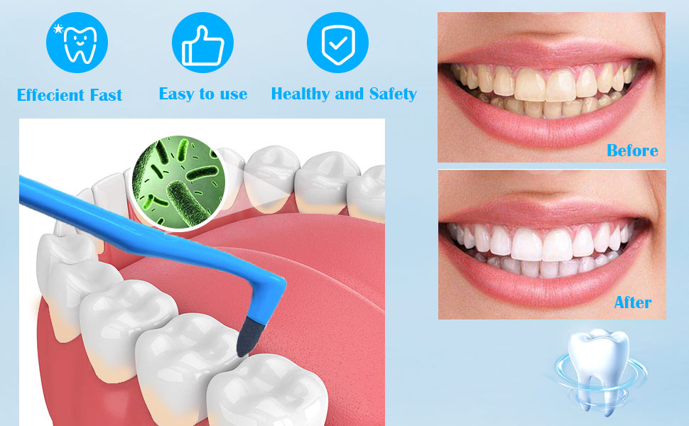 teeth cleaning plaque removal