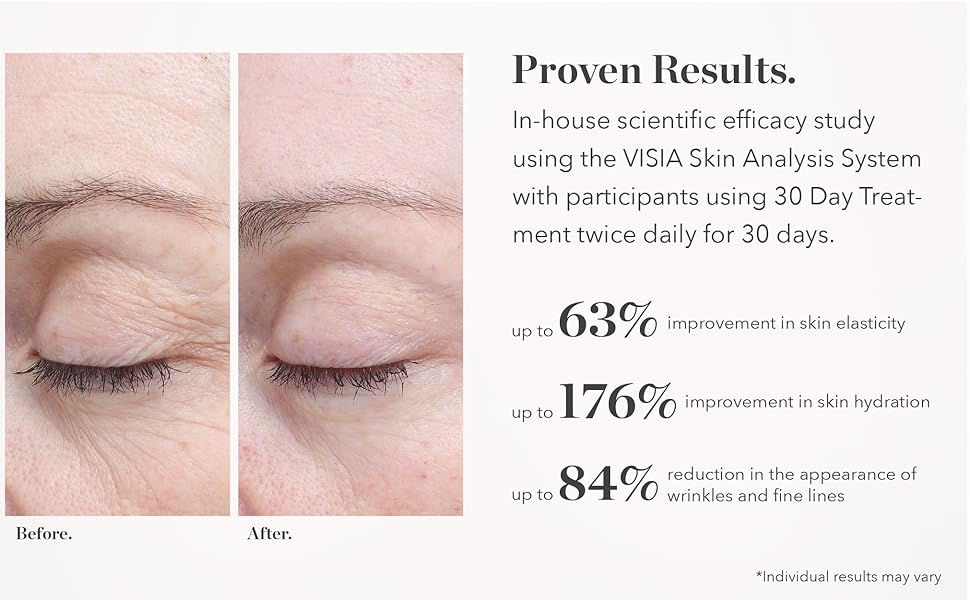 Proven Result Serum Improves Hydration, Skin Elasticity, Supports Collagen, Reduces Wrinkles