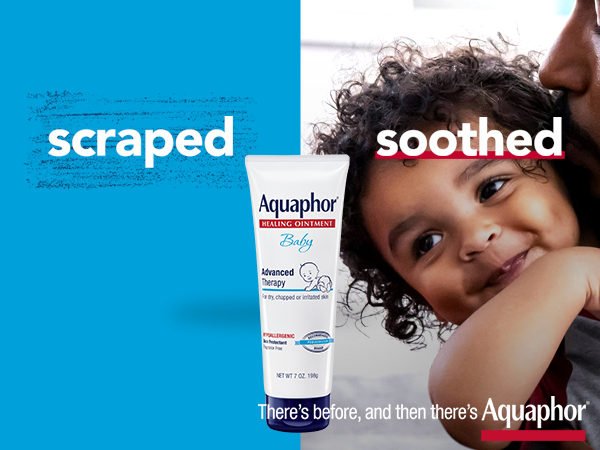Aquaphor baby healing ointment, ointment, baby diaper rash