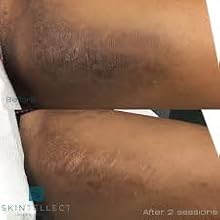 inner thigh mocha glow