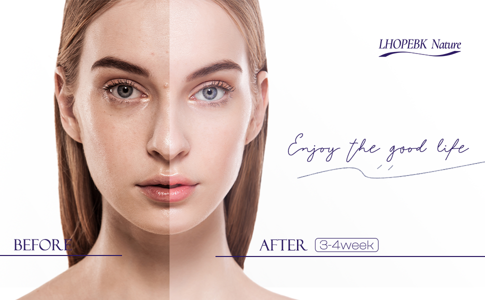 dark spot remover cream