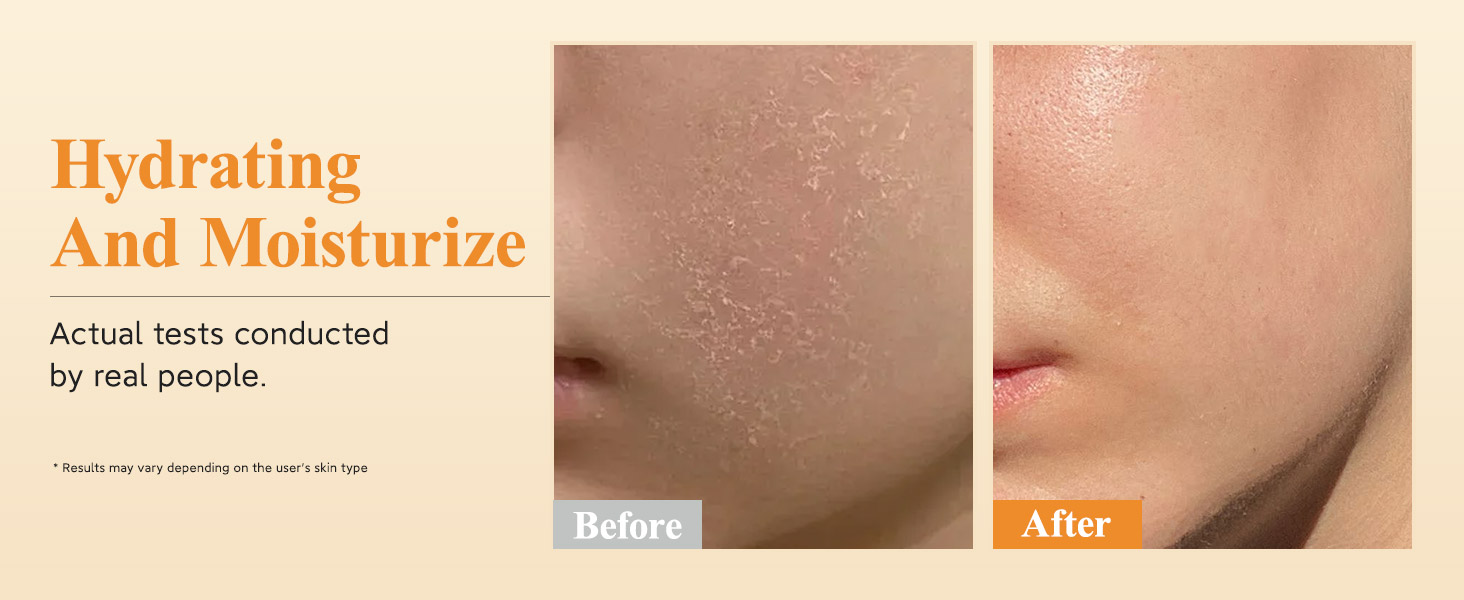 Hydrating And Moisturizing