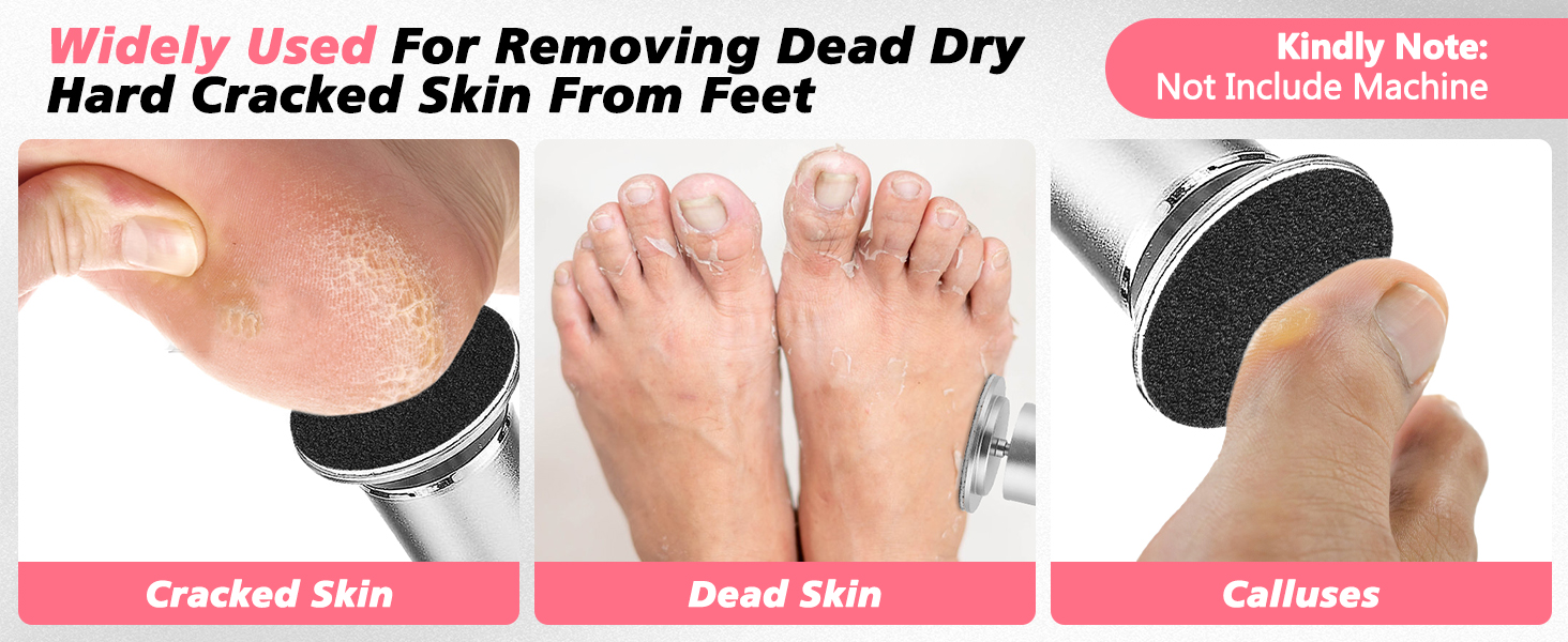 Foot File Replacement