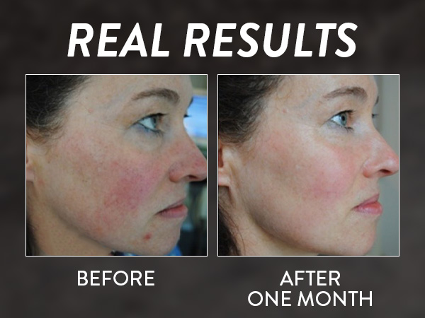 Before and after steamer Real results