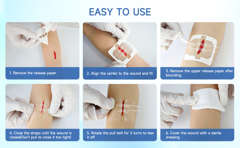 zip stitch wound closure device 