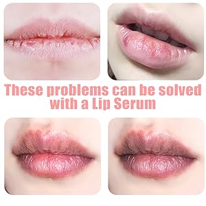 Lip Serum