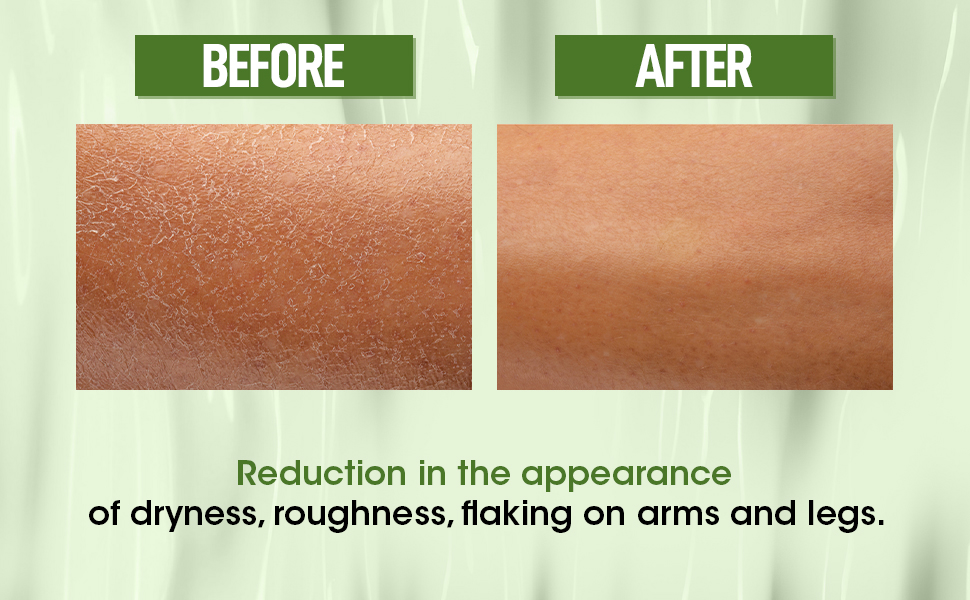 Lightweight, Non-Greasy Moisturizer for All Skin Types
