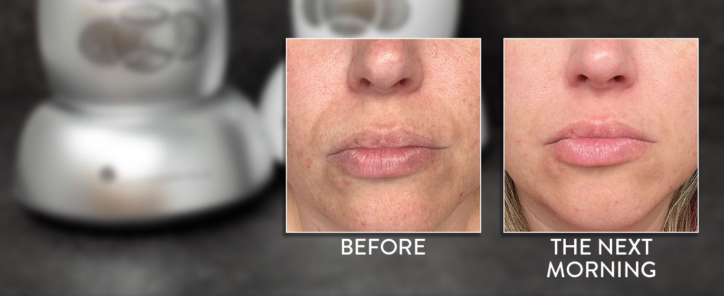 Before and After Real Results
