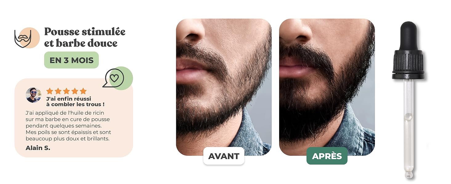 huile à barbe ricin bio de carapate castor amazon pousse rapide l ongle et cheveux pure sourcils