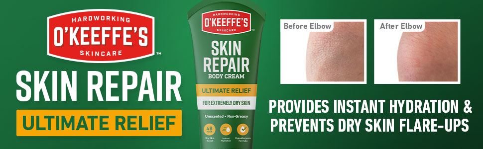 provides instant hydration and prevents dry skin flare ups