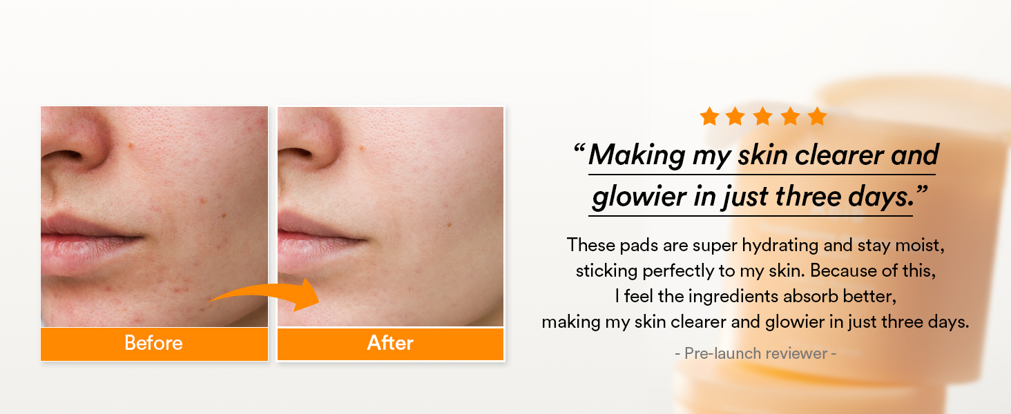 review: making my skin clearer and glowier in just 3 days