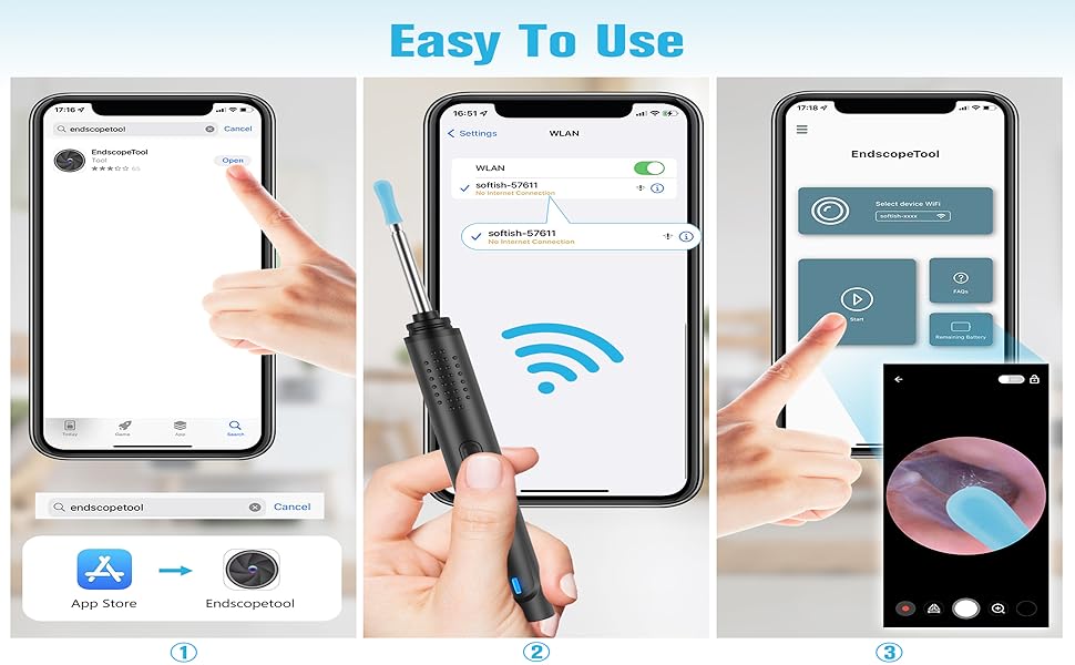 ear camera and wax remover for iphone