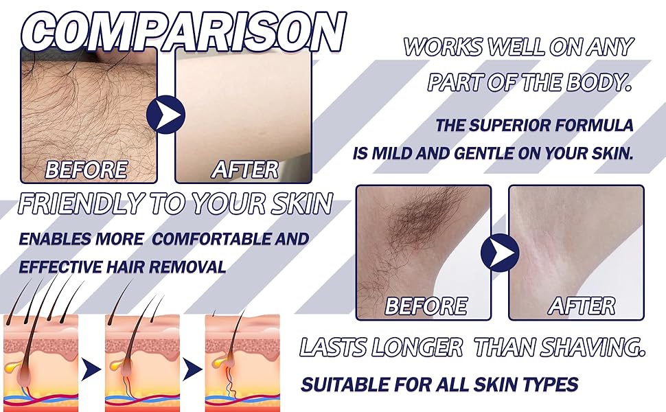 Hair Removal Cream for Men