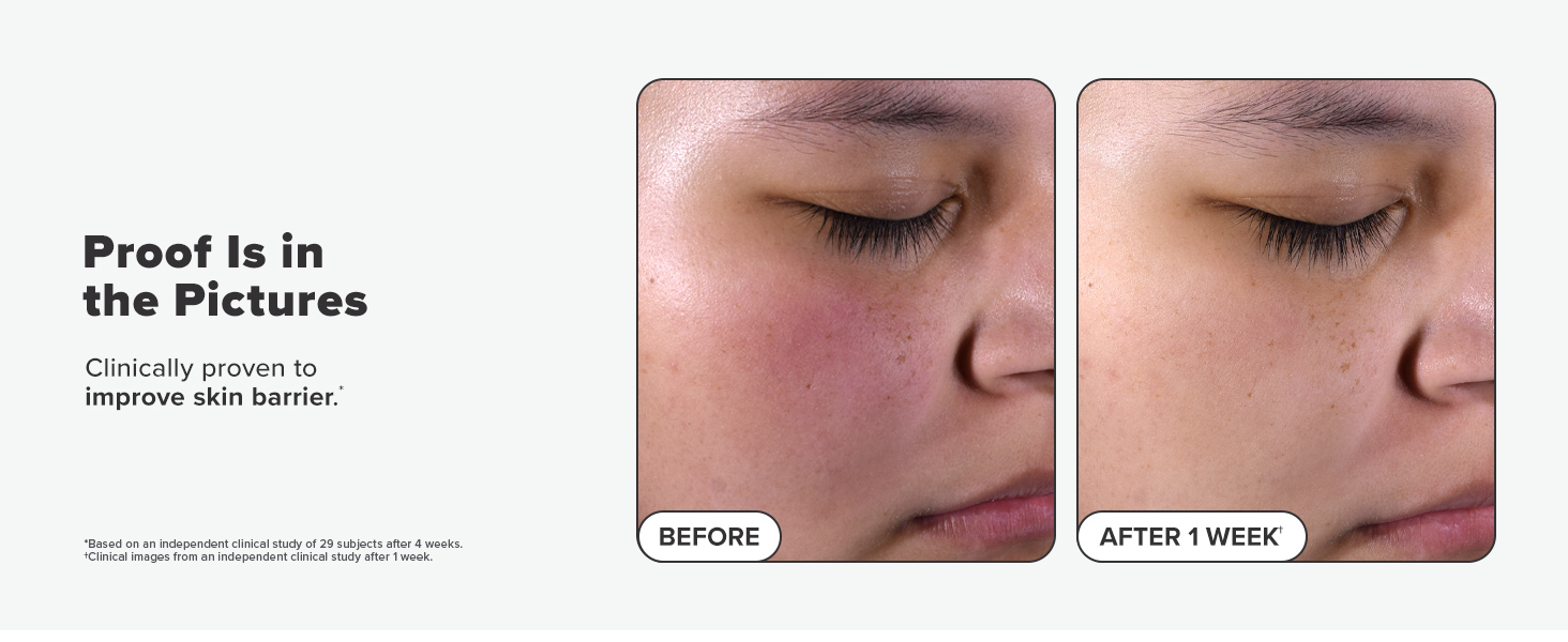 2% bha liquid exfoliant toner skin barrier