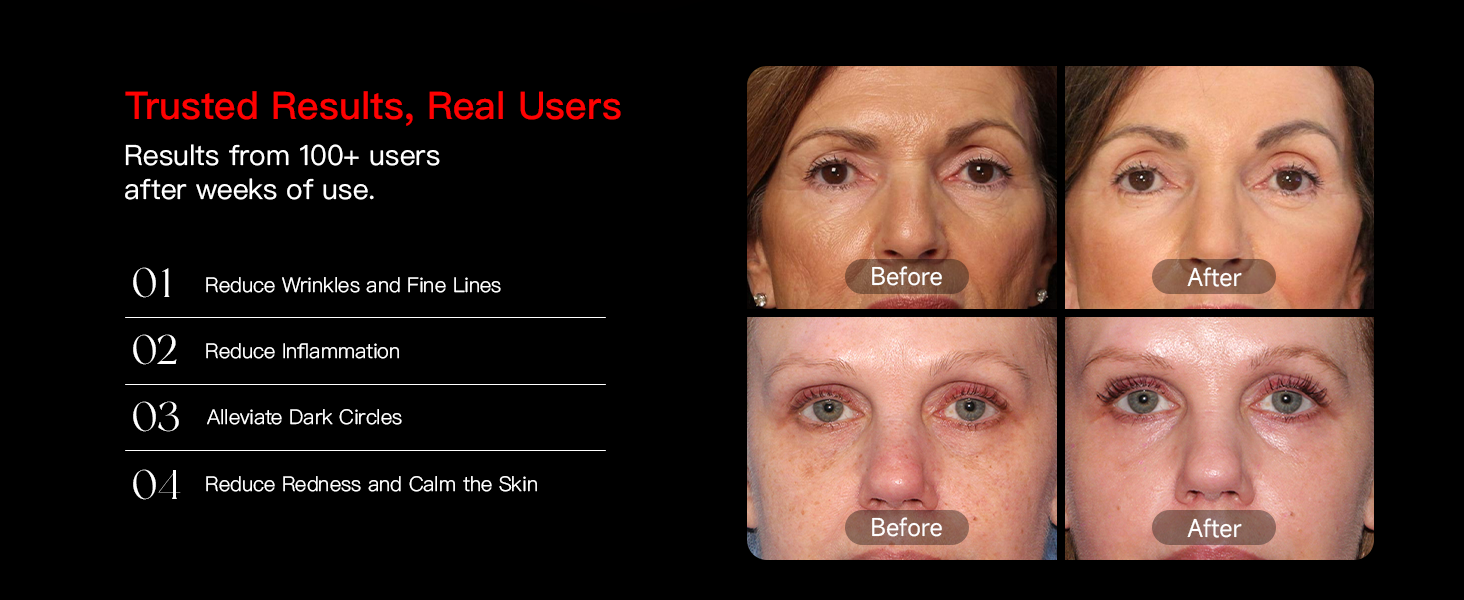 led light therapy face mask