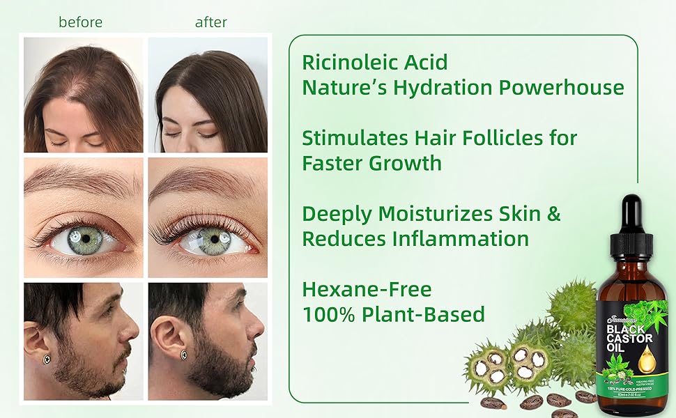 It promotes hair growth while also reducing hair loss