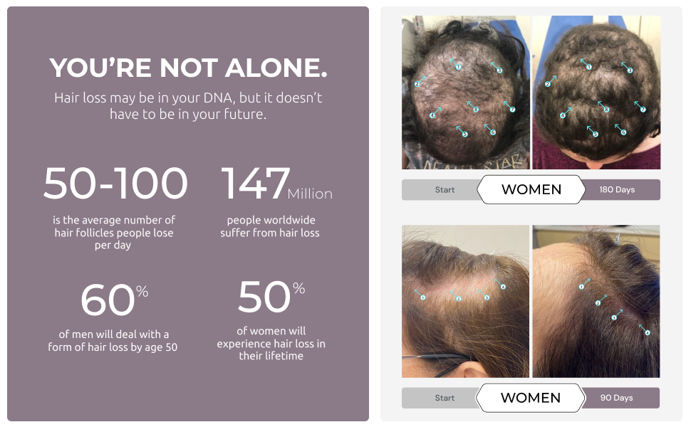 women hair loss thinning shedding growth regrowth serum oil for