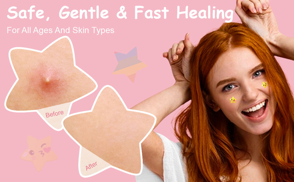 Acne Patch Pimple Patch