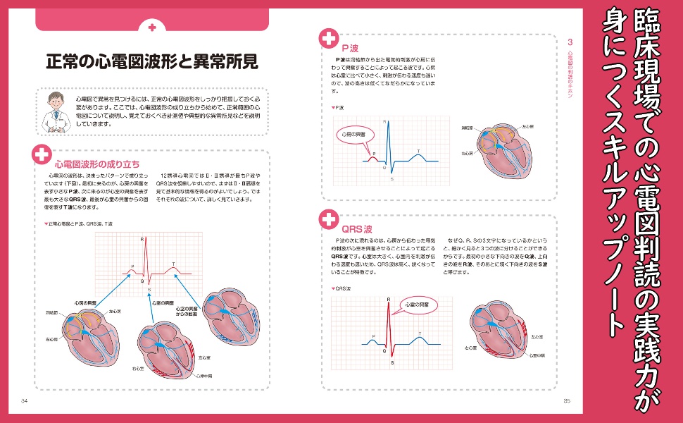 Amazon.co.jp: 看護の現場ですぐに役立つ 12誘導心電図のキホン eBook