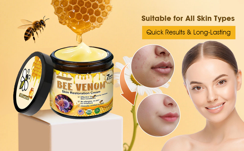 Bee Venom Skin Treatment Cream,bee venom comprehensive cream