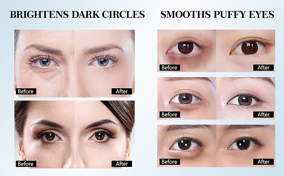 eye treatment products wrinkle patches undereye masks undereye bags