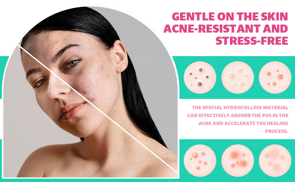 GENTLEON THESKINACNE-BESTENDIG ENSTRESS-VRIJ