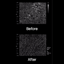 remove dead skin clearly