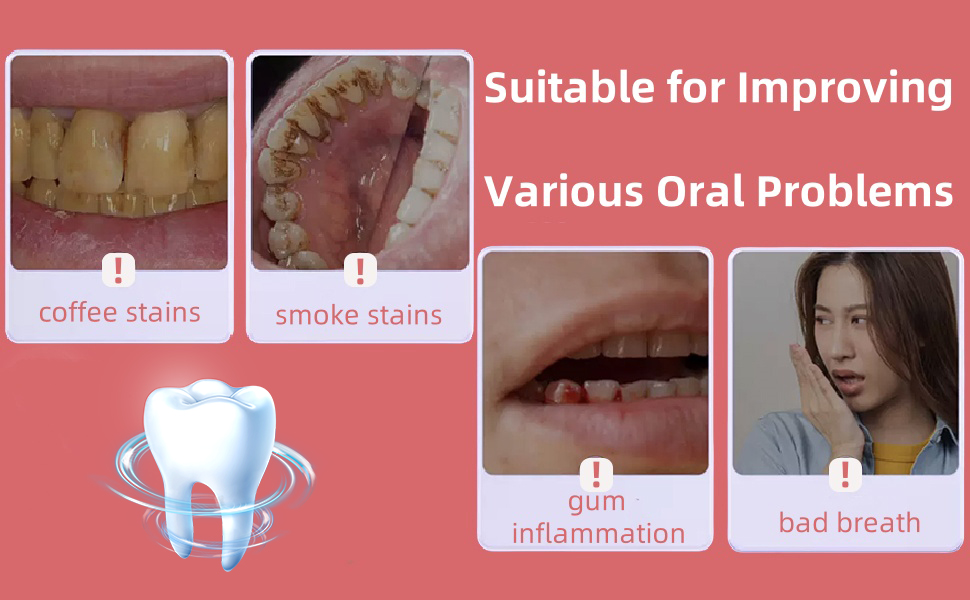 sp-6 ultra whitening toothpaste,sp-6 probiotics whitening toothpaste