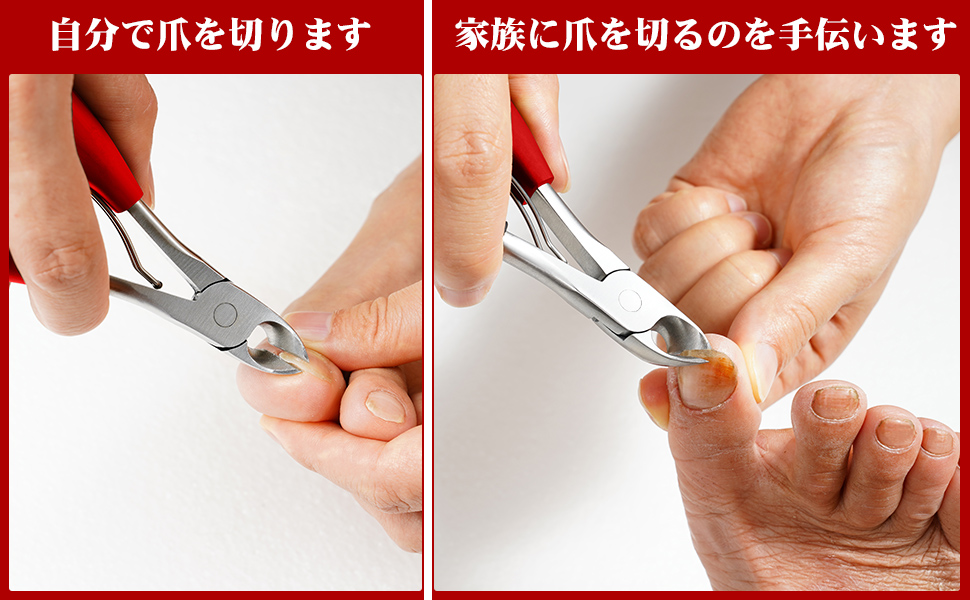 爪-おさえておきたい治療のコツ- (PEPARS(ペパーズ))No.86(2014年2月号)) 爪-おさえておきたい治療のコツ- (PEPARS(ペパーズ))No.86(2014