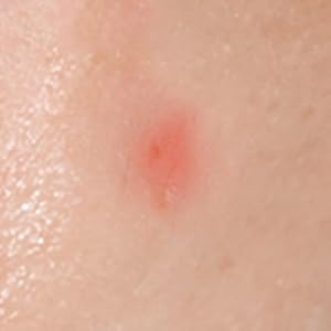 Spot Eraser Orange (Step 3)_5_1