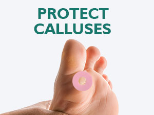 Corn Removers for Feet Protects Calluses