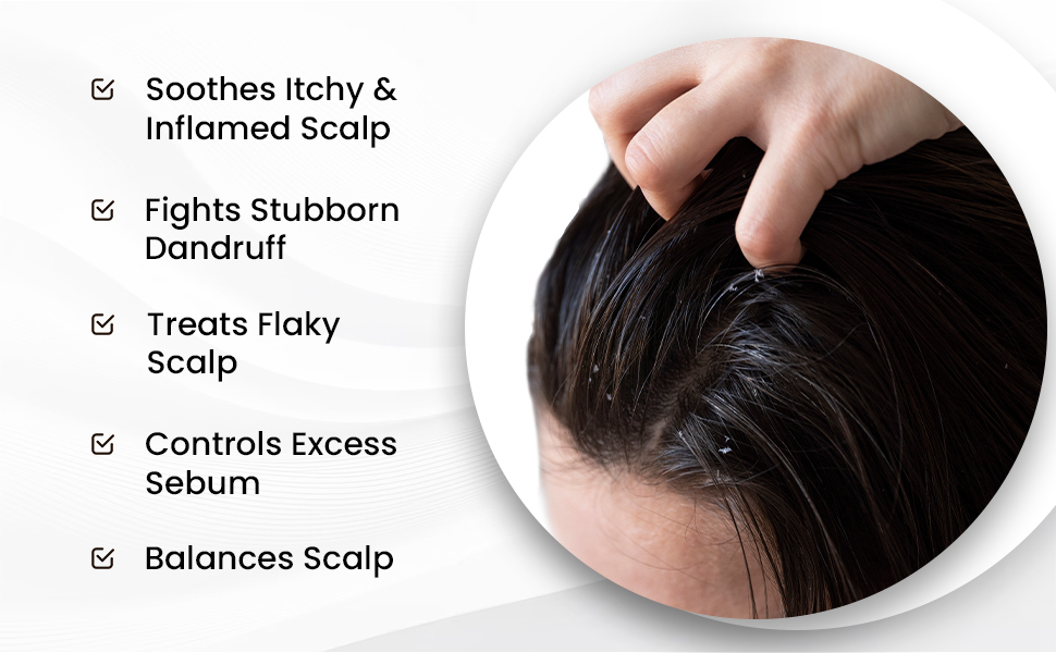 The Skin Story Anti-Dandruff Serum | Clean and Russian-free skulls | Reduces bunch, skull dryness and irritation. Promises healthy hair growth. Saniscalp & Evosina Gp Green | Non-Rasila | All hair types Light serum deepened dandruff while nourishing the skull and promoting healthy hair growth