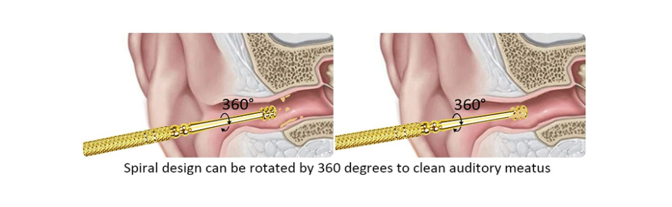 ear wax removal tool ear wax cleaner ear cleaning tool limpiador de oidos ear cleaner tool earwax 