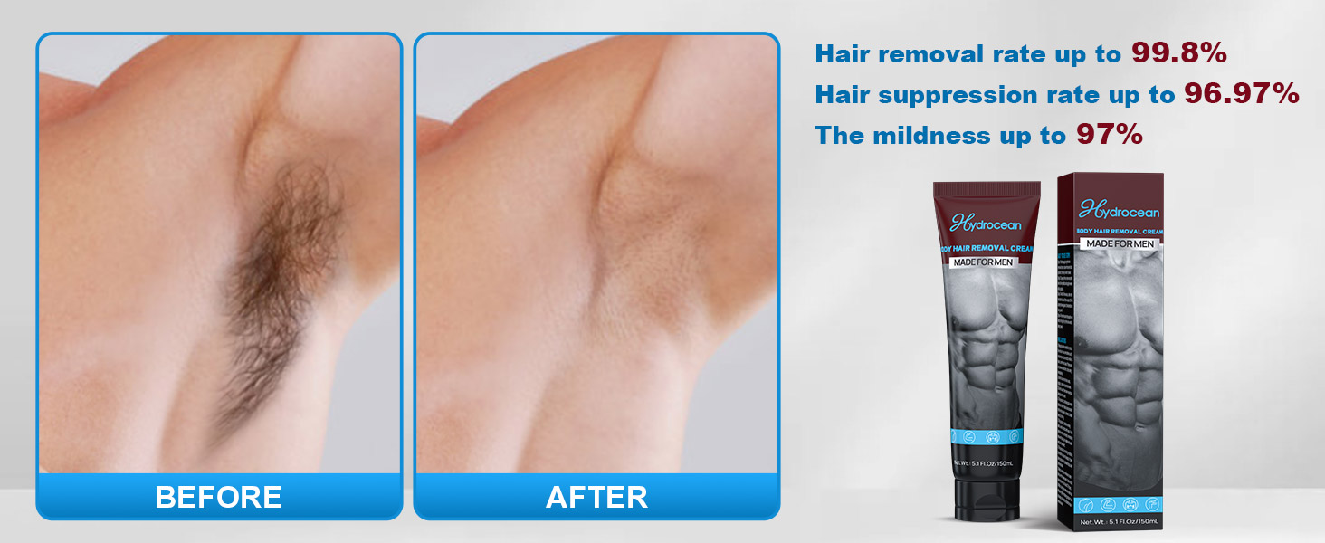 hair removal cream for men