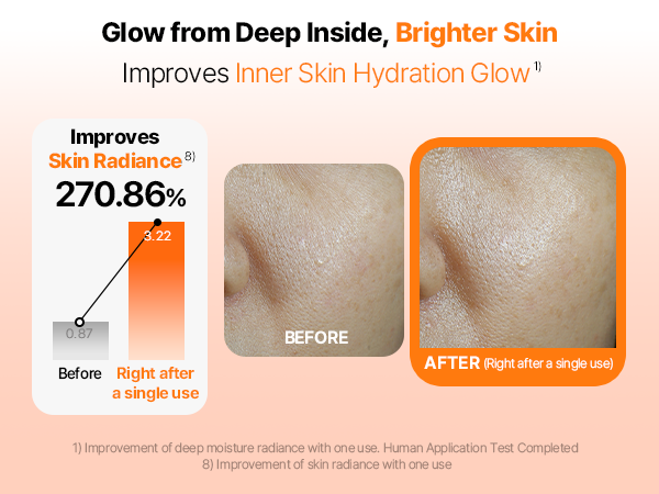 Amazon.com : CENTELLIAN 24 Madeca Lab PDRN Glow Gel Mask