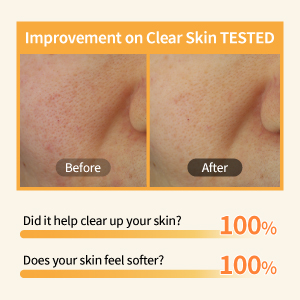 Vegan Pad, Unbleached, Niacinamide, Essence Pad, Korean Skin Care, numbuzin