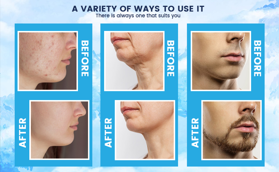 variety use of derma stamp