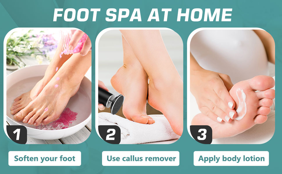  Electric Foot Callus Remover for Feet