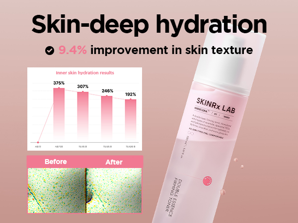 Amazon.com : SKINRxLAB MadeCera Cream Double Essence Firming