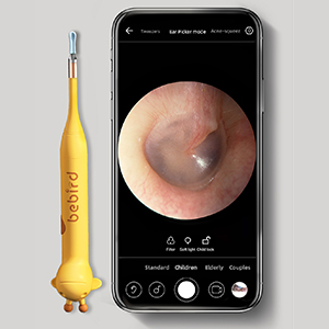 Ear Wax Removal 