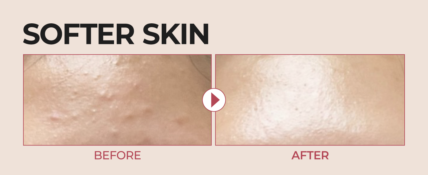Serum,Moisture,Korean Skincare,Facial Moisturizer,Skincare,Hydration,Korean Serum