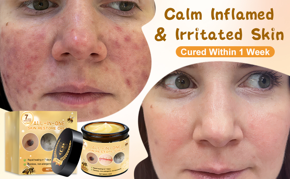 bee venom skin repair cream for Face and Body,Repair