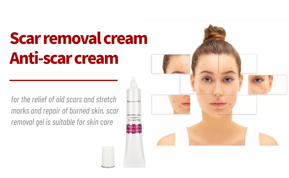 Scar removal cream
