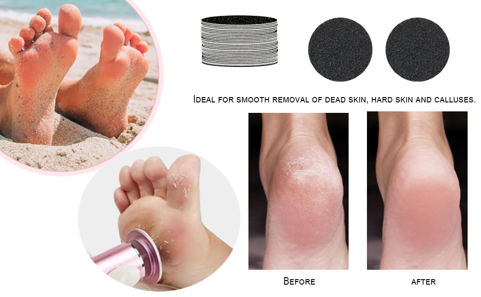 Electric Callus Remover Replacement Sandpaper Discs